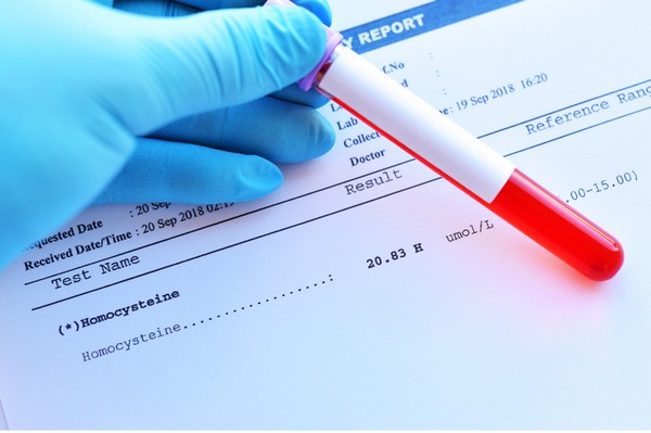 Homocysteine